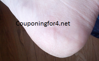 Toe Juice DermaVine Review